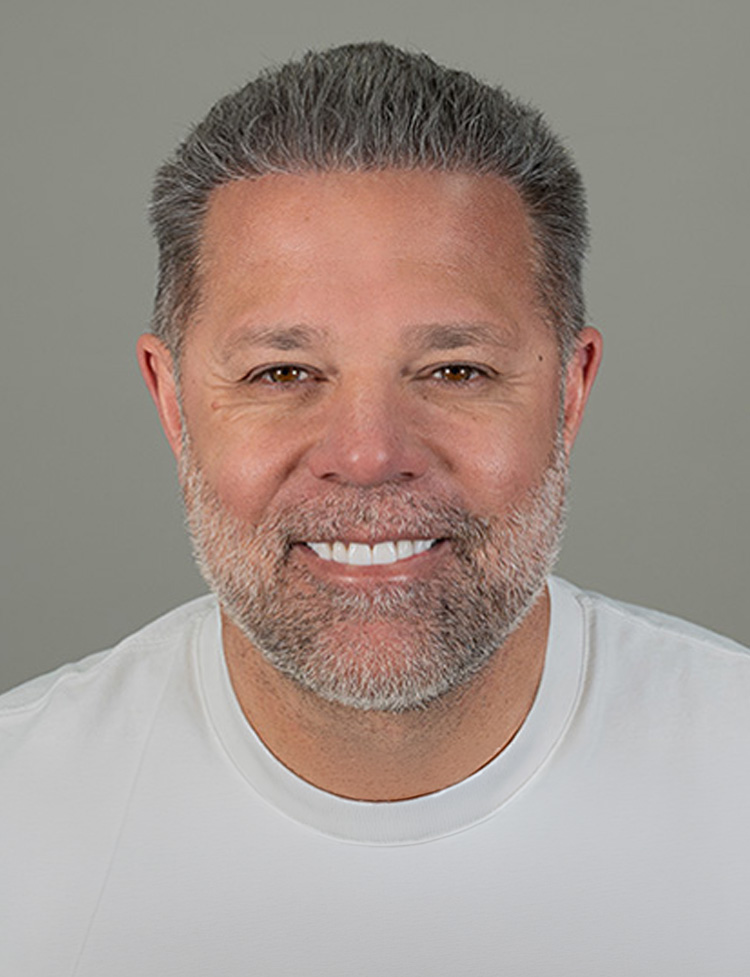 hair transplant before and after