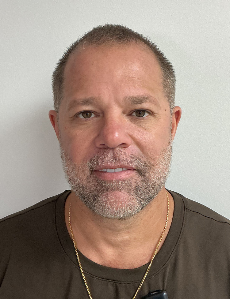 hair transplant before and after
