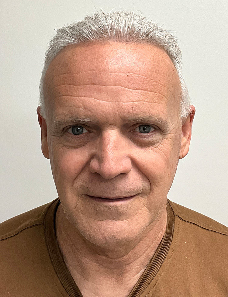 hair transplant before and after